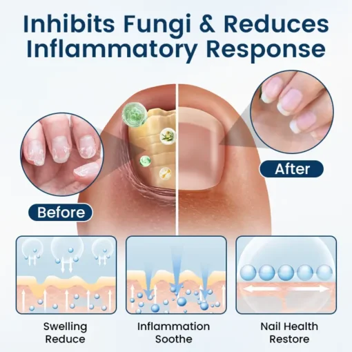 Timilk® OnyxiGuard Fungal Repair Herbal Spray