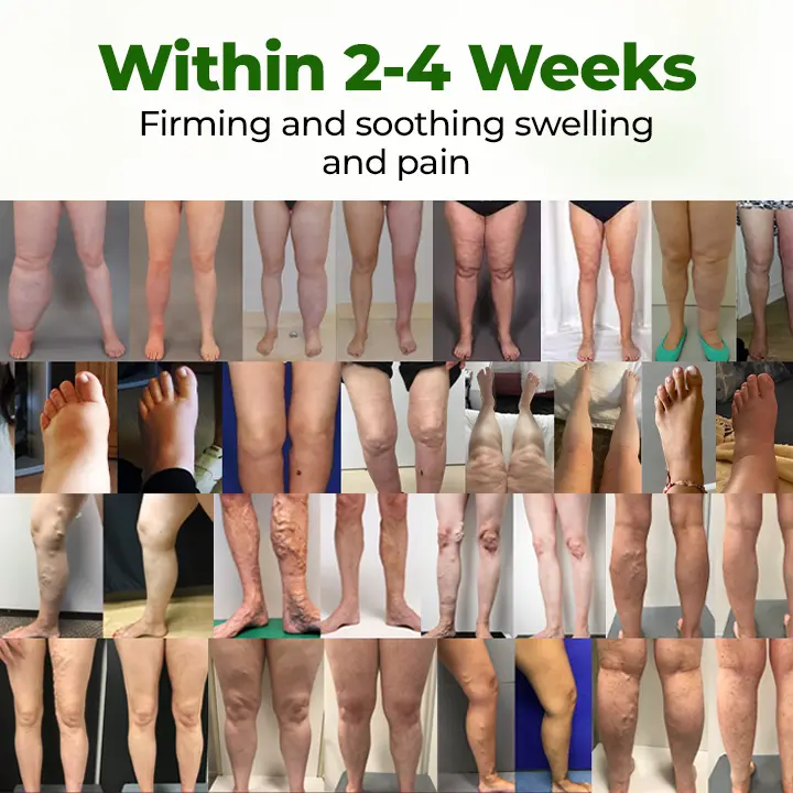 Timilk® Professional Leg Circulation Cream