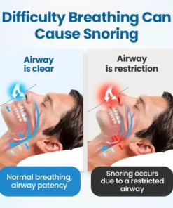 Timilk® SnoreLess Nasal Breather