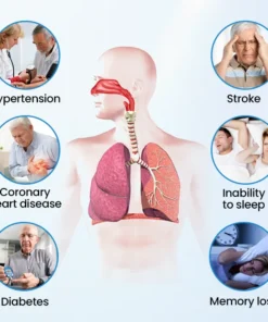 Timilk® SnoreLess Nasal Breather