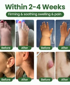 Timilk® BodyRelief Circulation Cream
