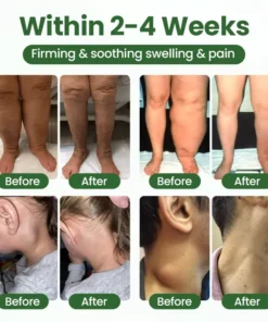Timilk® BodyRelief Circulation Cream