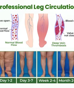 Timilk® BodyRelief Circulation Cream