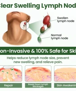 Timilk® BodyRelief Circulation Cream