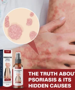Timilk® DermSoothe Psoriasis Relief Spray