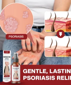 Timilk® DermSoothe Psoriasis Relief Spray
