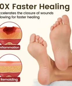 Timilk® DiaRelief Healing Cream