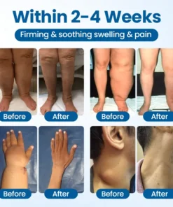 Timilk® Lymphora Swelling Relief Roll-On