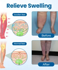 Timilk® Lymphora Swelling Relief Roll-On