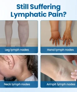 Timilk® Lymphora Swelling Relief Roll-On