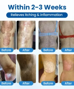 Timilk® Magnesium Herbal Treatment Spray