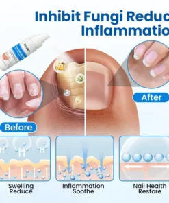 Timilk® Magnesium Herbal Treatment Spray