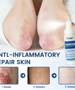 Timilk® PsoriCure Magnesium Herbal Spray