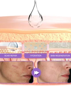 Timilk® RevivaDerma Face & Body Scar Gel