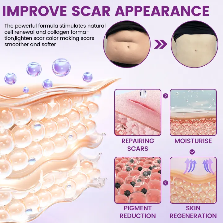 Timilk® ScarVanisher Scar Gel