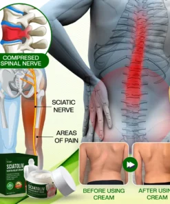 Timilk® Sciatoliv Sciatica Relief Cream