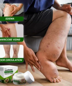 Timilk® SwellRelief Horse Chestnut Edema Cream