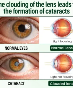 Timilk® VisionClear Nano Eye Drops