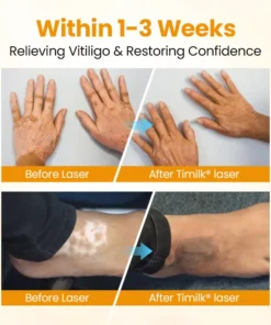 Timilk® VitiGone Rapid Spray