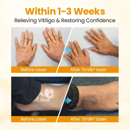 Timilk® VitiGone Rapid Spray
