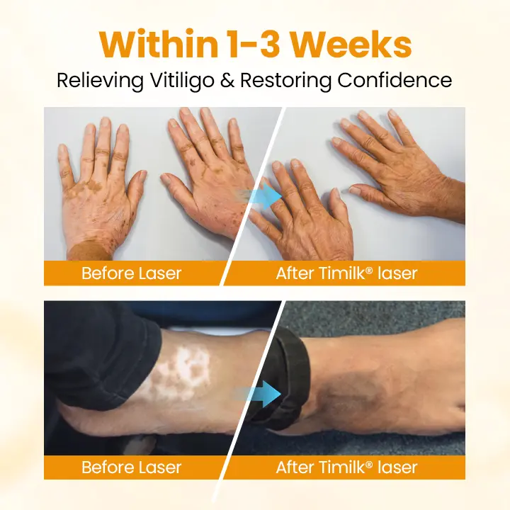 Timilk® VitiGone Rapid Spray
