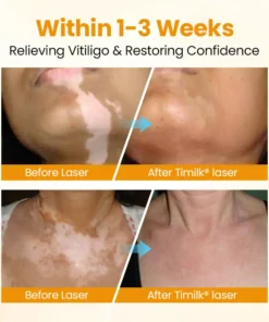Timilk® VitiGone Rapid Spray