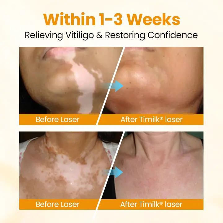 Timilk® VitiGone Rapid Spray