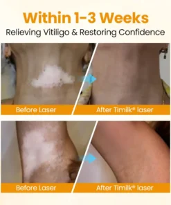 Timilk® VitiGone Rapid Spray