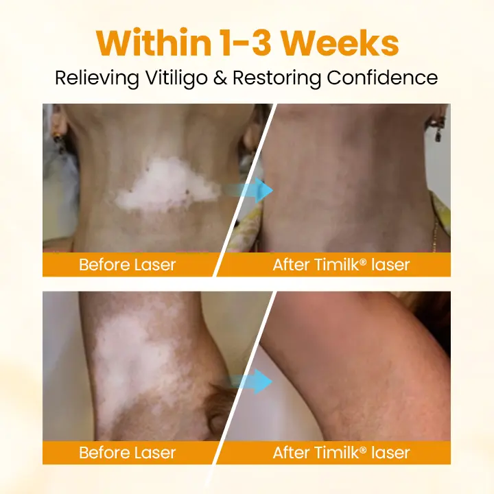 Timilk® VitiGone Rapid Spray