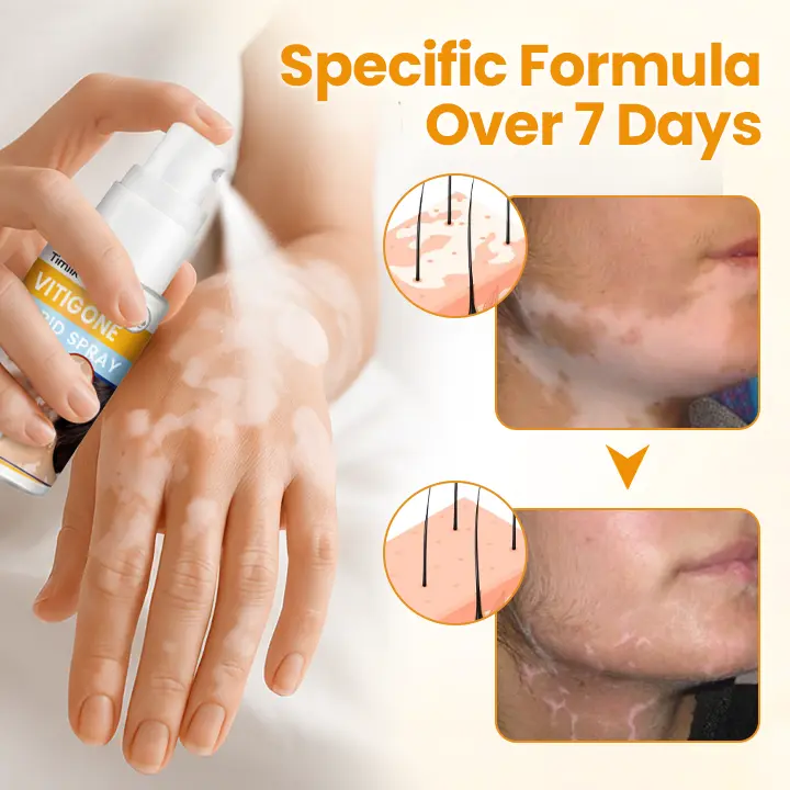 Timilk® VitiGone Rapid Spray