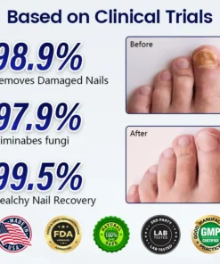 Timilk® Anti-Fungal Nail Repair Patch
