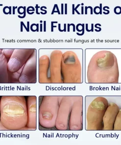 Timilk® Anti-Fungal Nail Repair Patch