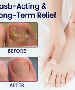 Timilk® Anti-Fungal Nail Repair Patch