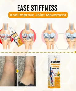 Timilk® ArthriGone Magnesium Oil & Bee Venom Joint Care Spray