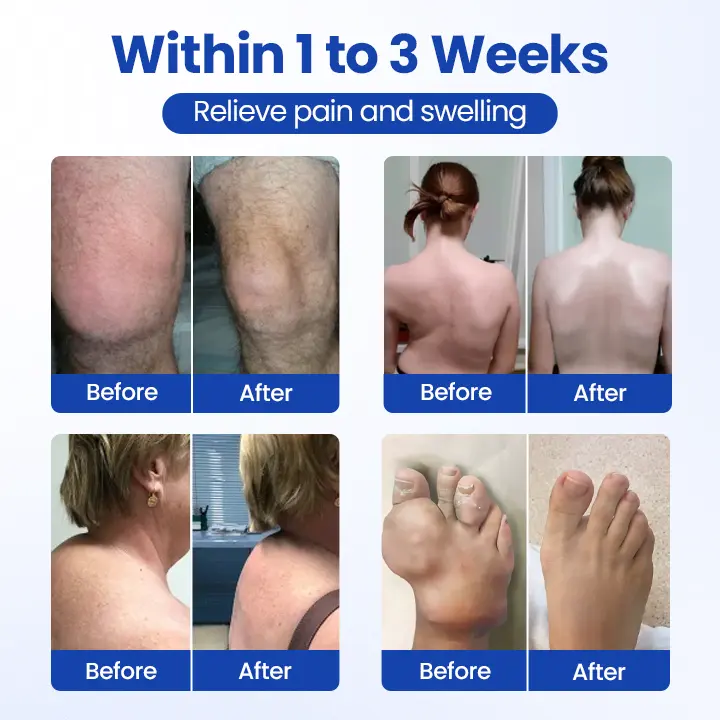 Timilk® BPC-157 Joint&Bone Repair Roll-On Gel
