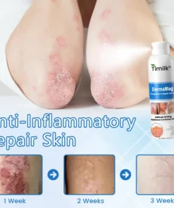Timilk® DermaMag Magnesium Repair Spray