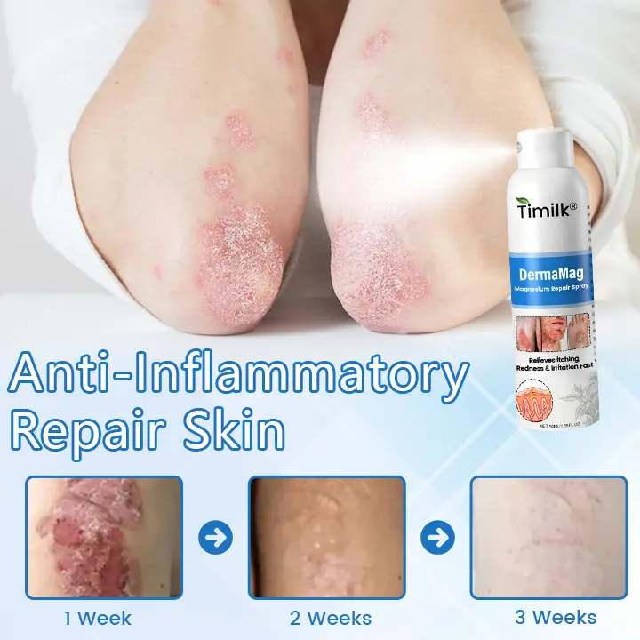 Timilk® DermaMag Magnesium Repair Spray