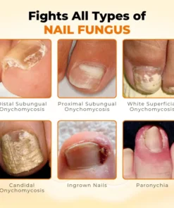 Timilk® NailRevive Bee Venom Anti-fungi Solution