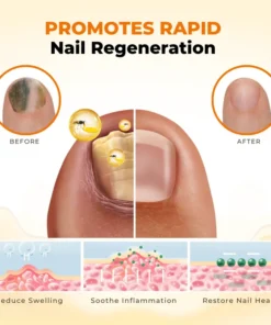 Timilk® NailRevive Bee Venom Anti-fungi Solution