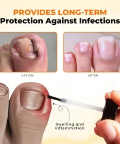 Timilk® NailRevive Bee Venom Anti-fungi Solution
