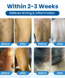 Timilk® PCA Magnesium Deep Repair Spray