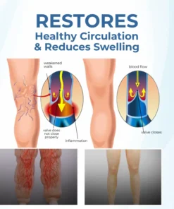 Timilk® TheraVein Varicose Herbal Spray
