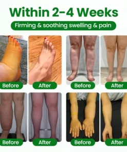 Timilk® VenoLift Leg Relief Spray