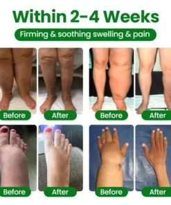 Timilk® VenoLift Leg Relief Spray
