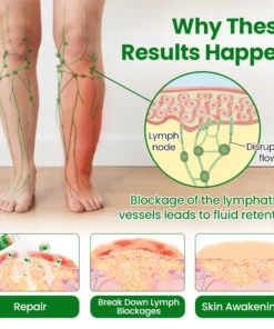 Timilk® VenoLift Leg Relief Spray