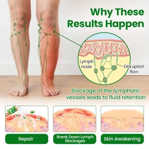 Timilk® VenoLift Leg Relief Spray