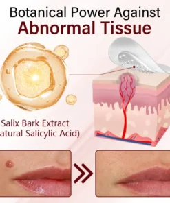 Timilk® Vionara Nano WartErase Patch