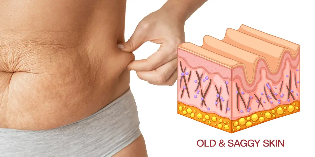 Timilk® AuréLuxe Body Firming Oil