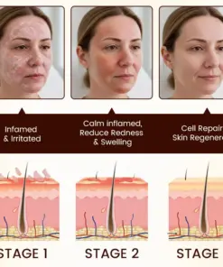 Timilk® Bee Venom Multi-Repair Cream