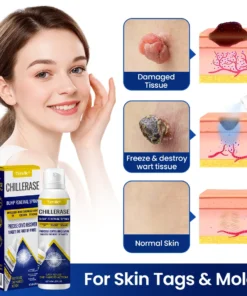 Timilk® ChillErase Bump Renewal Spray